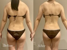 エステティック ミュー(Esthetic MiEUX)