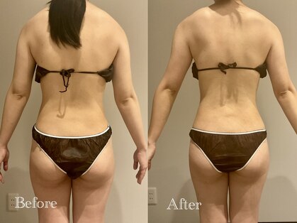 エステティック ミュー(Esthetic MiEUX)の写真