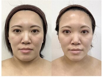 サロン ド グレース(Salon de Grace)/リフショック桑名1の引き上げ!