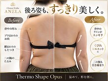 アネラ(ANELA)の雰囲気（ラジオ波で深部を温め、形を創るボディケア）