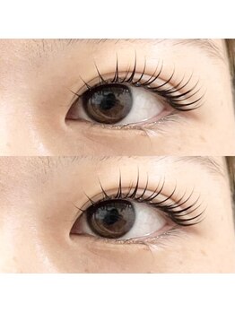 abp /ラッシュリフト