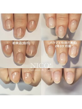ニコプラス(NICO+)/自爪育成中
