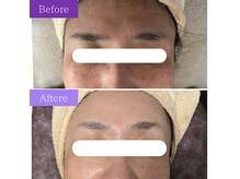 フェイシャルケアでふっくらハリ透明肌♪若々しく明るい印象に