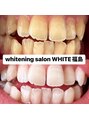 ホワイトニングサロン ホワイト(WHITE)&nbsp;【大阪/梅田/ホワイトニング/セルフホワイトニング/ブライダル】