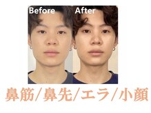 ラプリ 大阪心斎橋店(Raplit)の雰囲気（小さくスッキリとした小鼻に☆顔と鼻の豆知識はブログに多数あり）