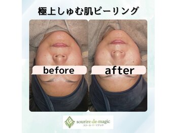 スリールドマジック(sourire de magic)