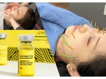 ウィズ鍼灸整骨院 十三院(with.鍼灸整骨院)の写真/【新登場★】韓国発最新レモンボトル×美容鍼の最強コラボ！内側＆外側から美と健康をサポート♪