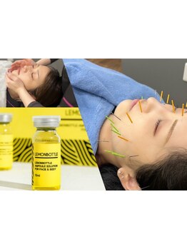 ハリツヤをUPしたい