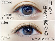 ノーチェ(Noce)