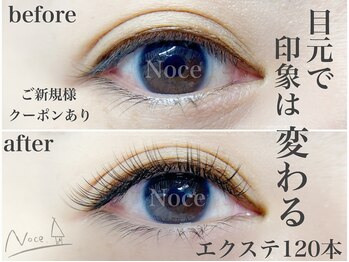 ノーチェ(Noce)