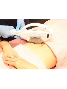 デリケート部分の脱毛/Vライン/VIO