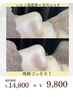 【毛穴の黒ずみ除去】毛穴エクストラクション￥14800→￥ 9800　180分