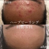 クリアビューティー(CLEAR BEAUTY)