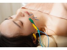 リリーフポート フェミナ鍼灸整体院 大濠公園店/施術風景：電気美容鍼【たるみ】