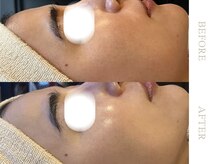 ソワ 恵比寿(soi)/ENVIRONエンビロンフルコース