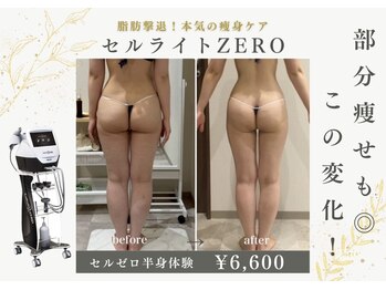ナチュールファースト(naturel first)の写真/【隠してた部分、出せる身体へ】
気になるヒップと脚の脂肪を集中撃退！