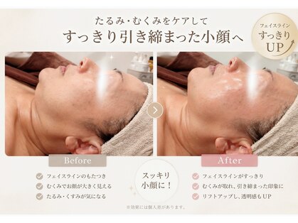 ルメリア(Lumelia)の写真