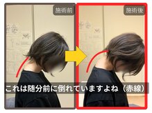 まこと整骨院/寝違いのような首の痛み３