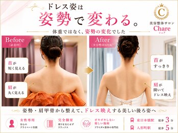 シェア 人形町店(Chare)の写真/本気で痩せたい方はChareへお任せください★独自のブライダルエステ(整体)×痩身で脂肪・ハミ肉を徹底ケア!