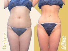 ビアン 四条烏丸(BIAN)/ビフォーアフター写真