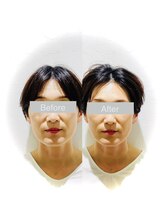 ワカヤマ 小顔(Wakayama)/★Before・After★