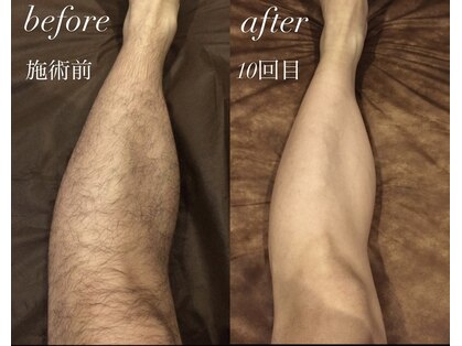 ベイビースキン(Baby skin)の写真