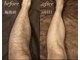 ベイビースキン(Baby skin)の写真