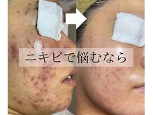 シースタイル(C-S.t.y.l.e.)の雰囲気（繰り返すニキビの原因にアプローチ！頑固なニキビを徹底ケア）