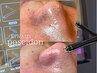【毛穴をキレイに♪】トルネード水流で毛穴洗浄＆引き締めお試し50分￥7890