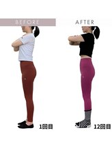 ステップフロウ(Step flow)/前ももの張り・反り腰改善