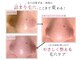 ルームエイトエイティスリー 新宿(R883)の写真/【透明感UP/うるつや美肌】全顔スチーム毛穴洗浄+プラズマ+炭酸パック+ビタミンC美容液導入