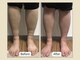 ミリュー(mylieu)の写真/《便利で通いやすい駅チカ!!》温活で辛いむくみとサヨナラ!!発汗を良くし老廃物の排出を促進します!!