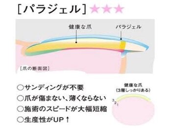 ピンクローズ(Pink Rose)/パラジェルの仕組み