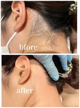 ハリウッドブロウリフト ワクシー 蒲田店(HOLLYWOOD BROW LIFT WAXYYY.)/夏本番！うなじのケア！