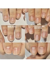 ニコプラス(NICO+)/自爪育成中