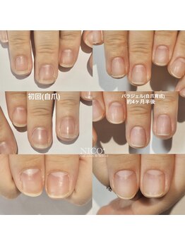 ニコプラス(NICO+)/自爪育成中