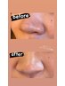 口コミ投稿で小鼻のwax脱毛サービス♪