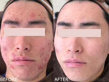 ビアンカ/お客様のお声