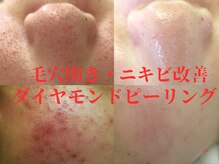 サロンドエステケイワイ(de KY)