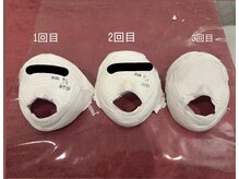 シャルム(CHARME)/小顔コルギ