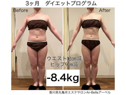 アーベル(Ar-Belle)の写真
