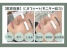 ビオフィート★口コミ/モニター協力【毛穴ケア・赤み・ニキビケア・くすみ】