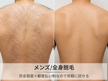 フルーブラン(Frubran)/【メンズ脱毛】つるすべ肌へ