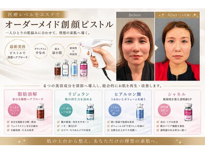 ルアナ(Luana)の写真