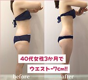グッドライフエステ