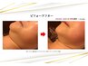 【小顔になりたい!脂肪燃焼】デコルテ・ヘッドマッサージ付き¥9800→¥7500