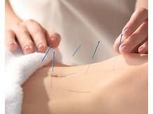 いちかわレディース鍼灸院/【妊活・温活】　鍼灸+ラジオ波