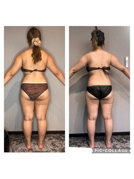 ブリス(bliss)/ウィンバック痩身効果！