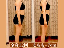 サロン セドナ(SALON SEDONA)/全身リンパ痩身 12回～24回