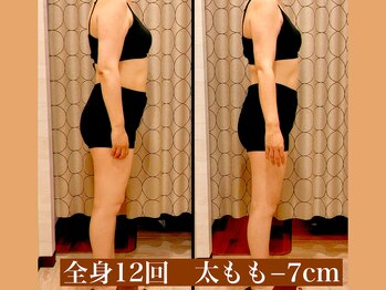 サロン セドナ(SALON SEDONA)/全身リンパ痩身 12回~24回